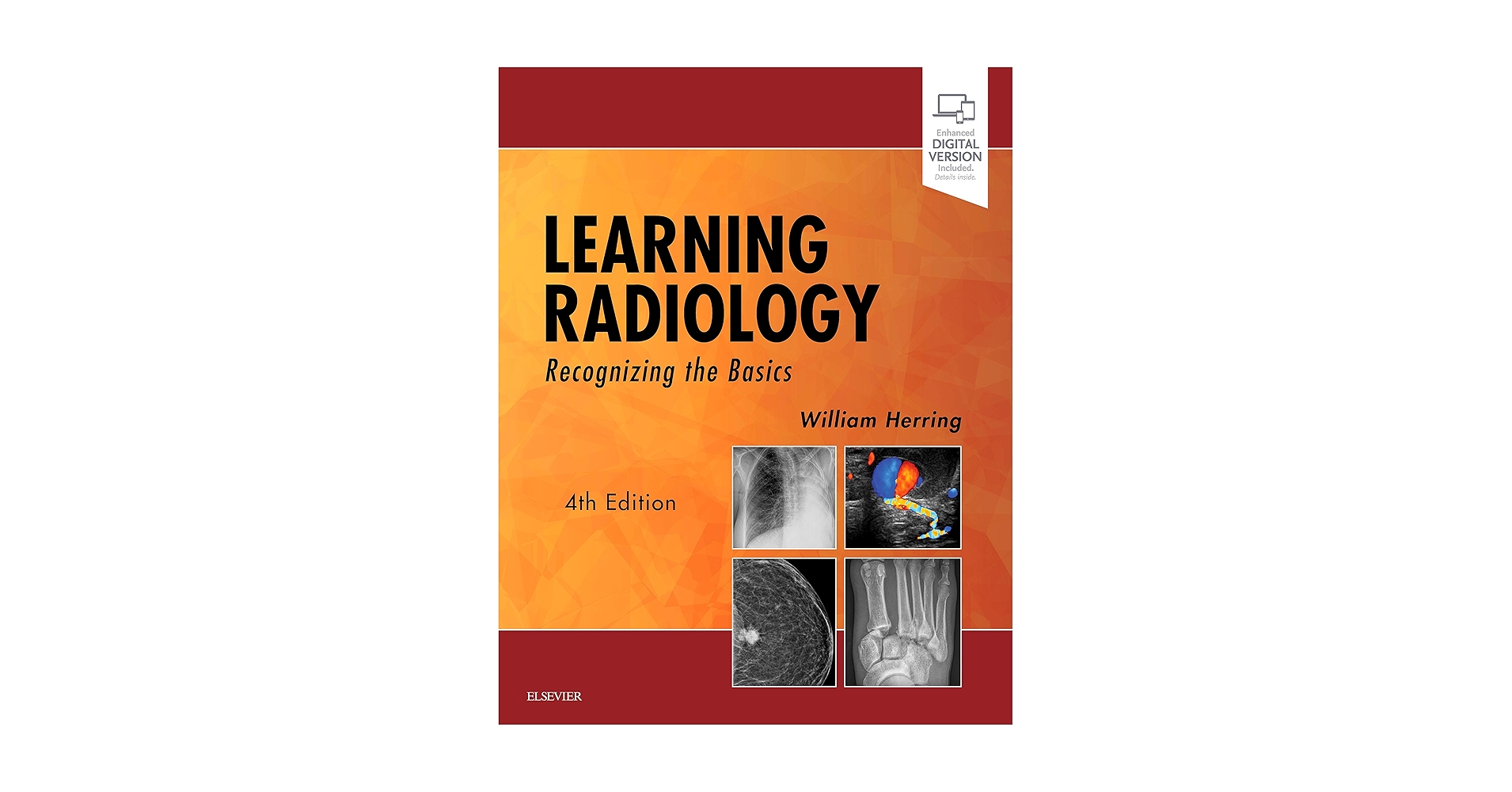 Amazon.com: Learning Radiology: Recognizing the Basics